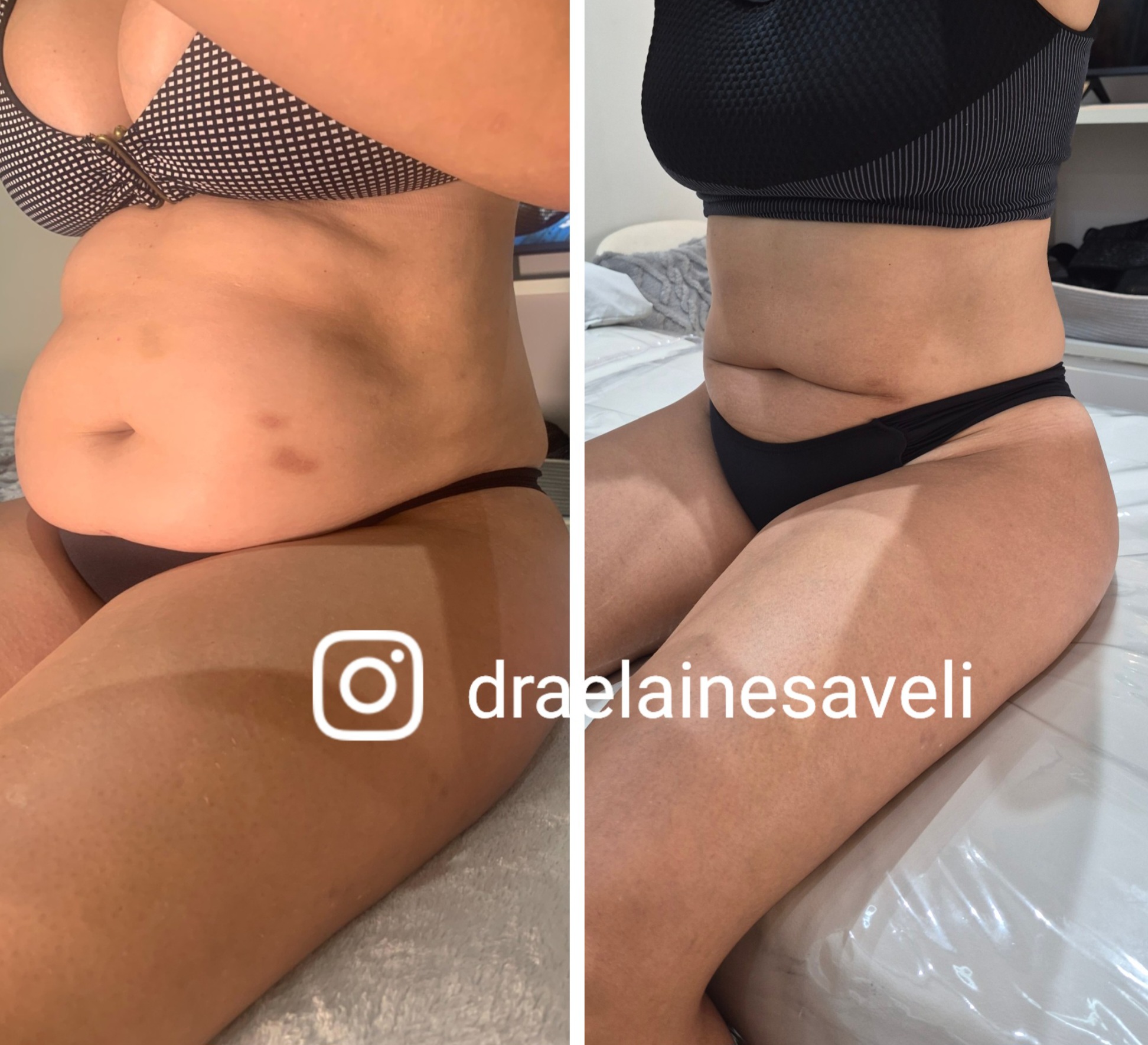 Antes e depois · Body Sculpt