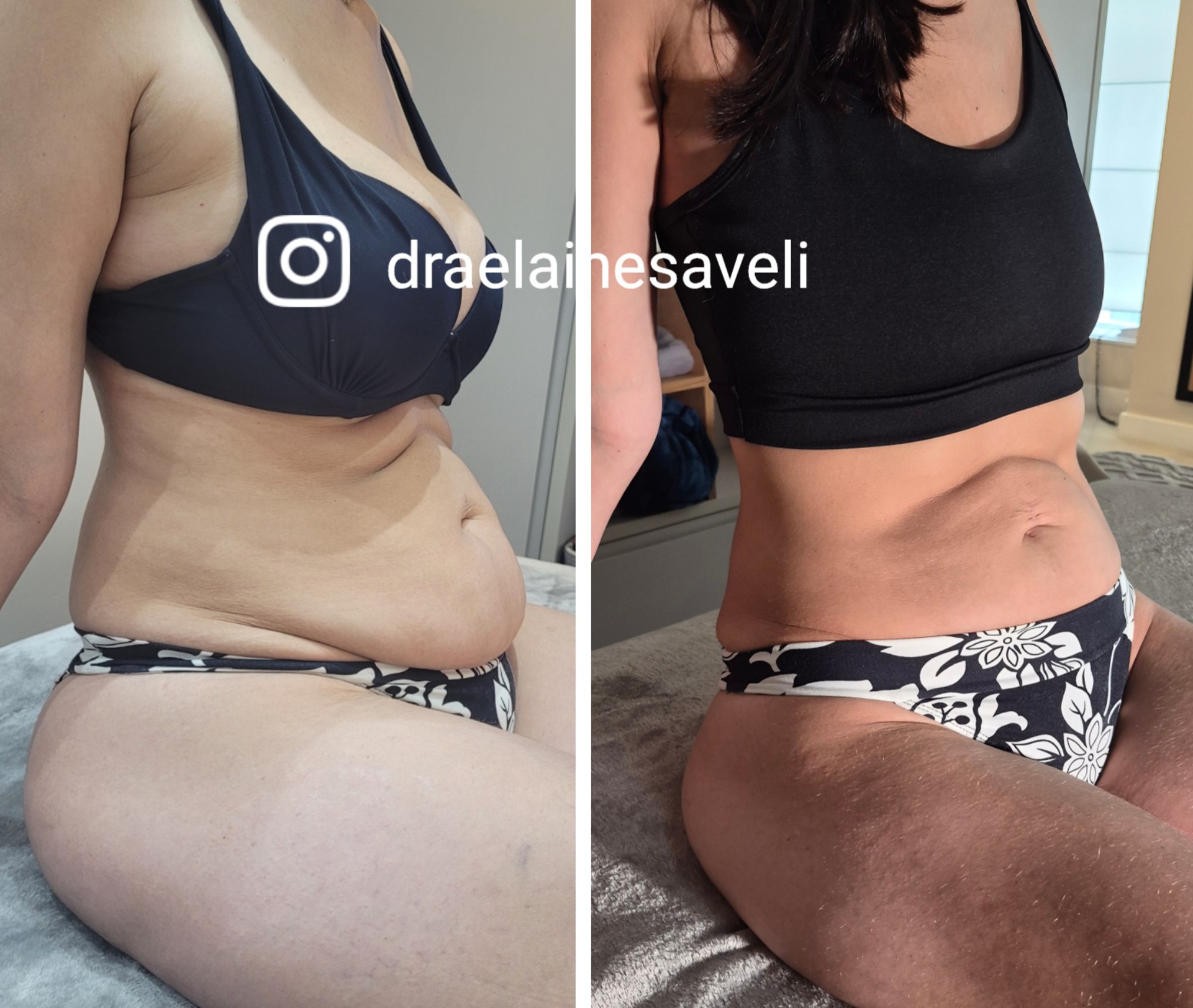 Antes e depois · Body Sculpt