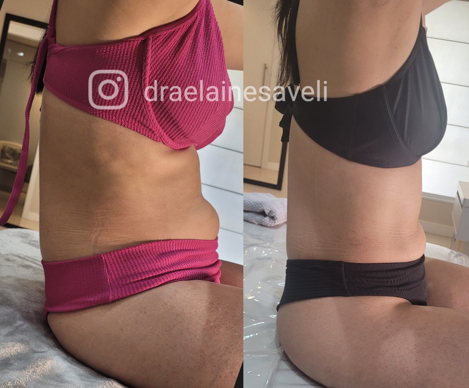 Antes e depois · Body Sculpt
