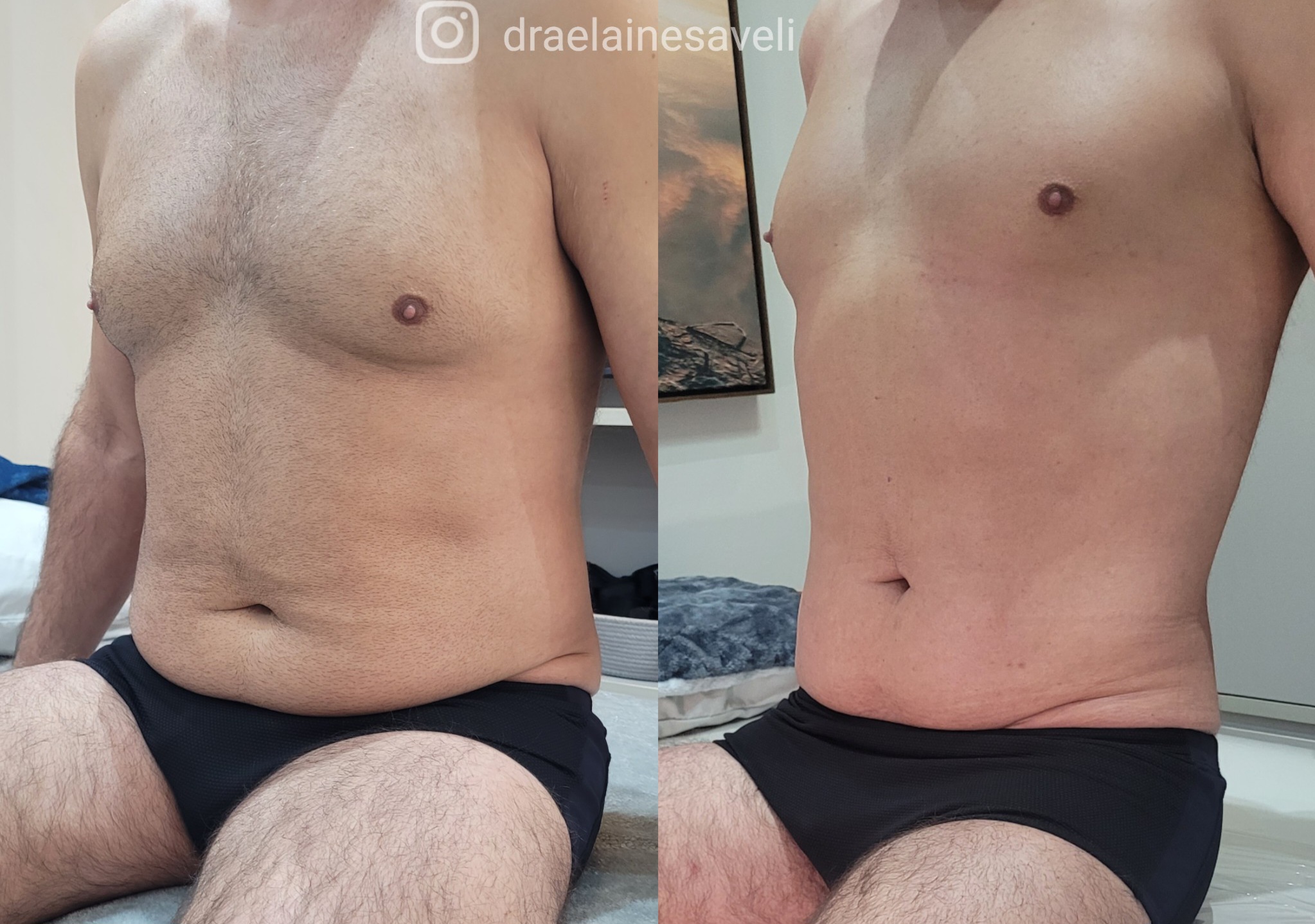 Antes e depois · Body Sculpt