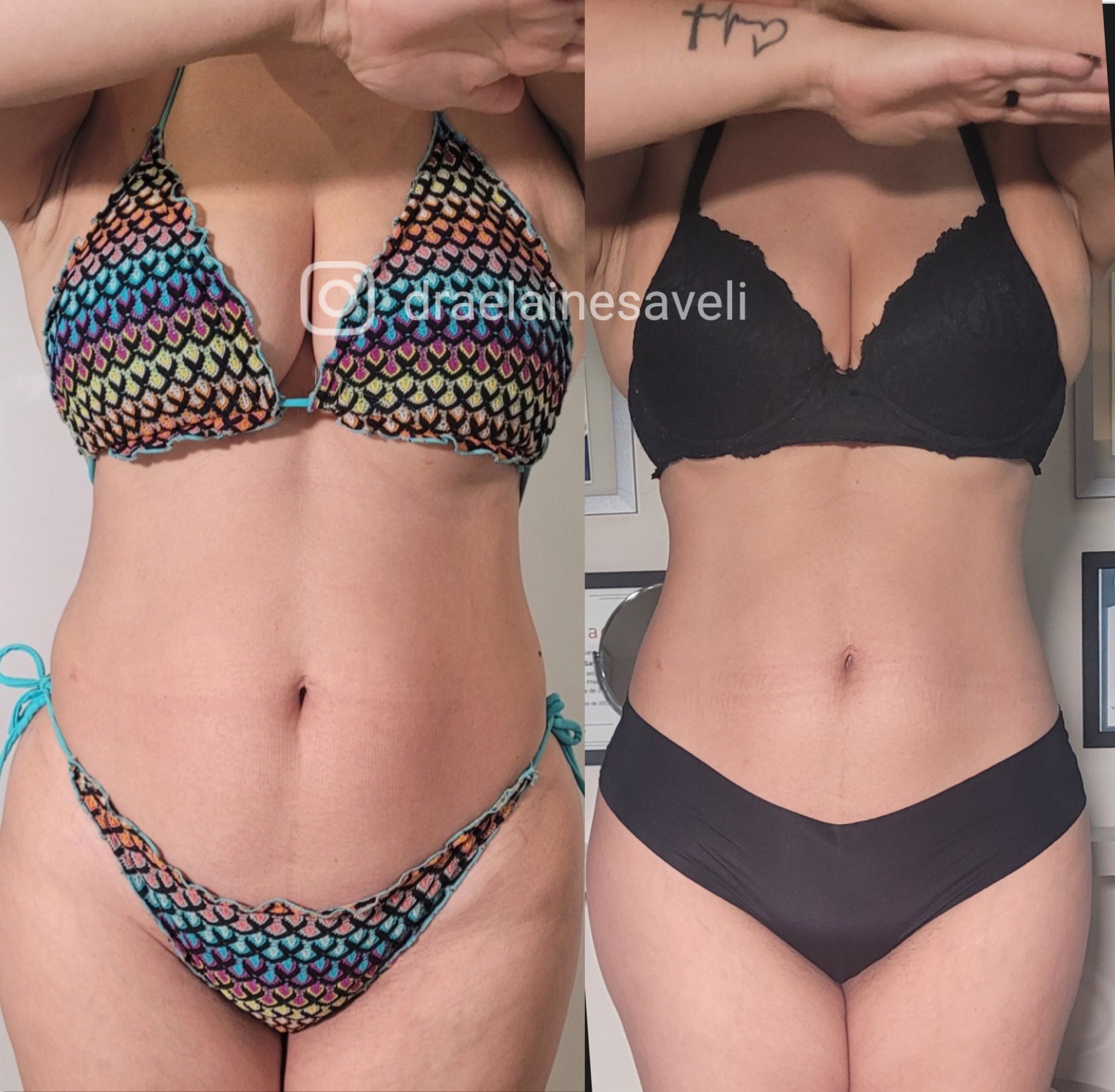 Antes e depois · Body Sculpt